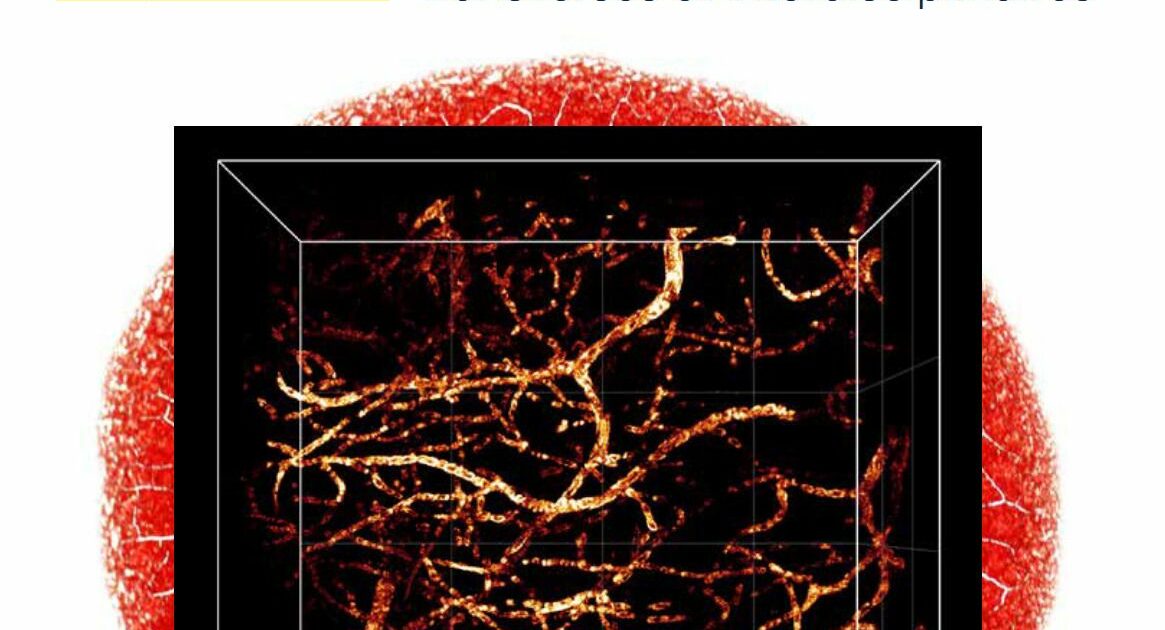 Exposition "Stratigraphie des recherches en santé" — Palaiseau